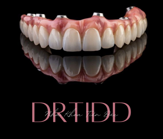 Trồng răng Implant toàn hàm